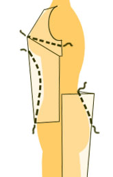 Illustration - Abnäher